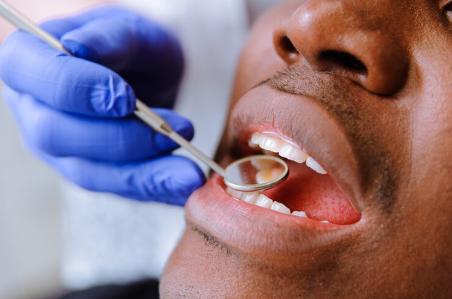 Teeth Whitening